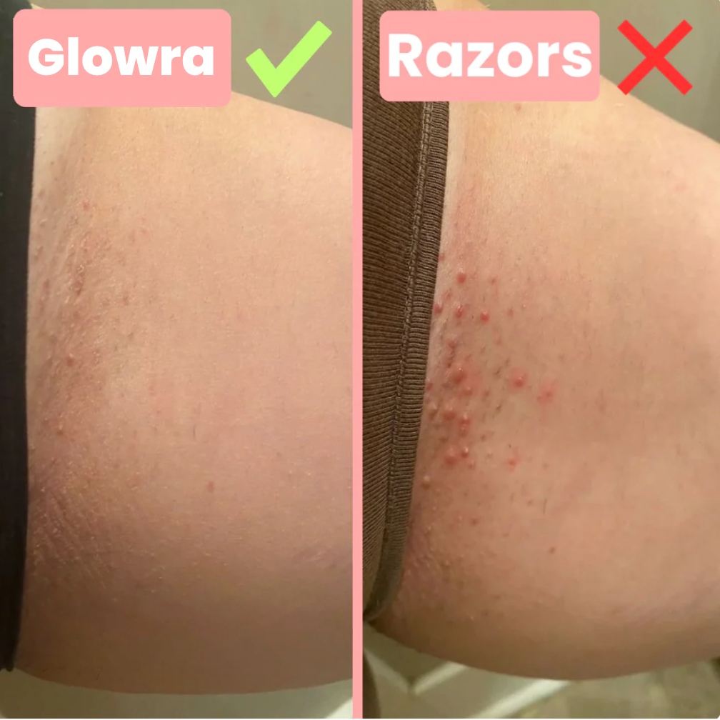 Glowra SilkGlide